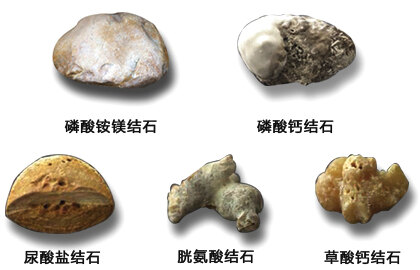 结石石头种类图解图片