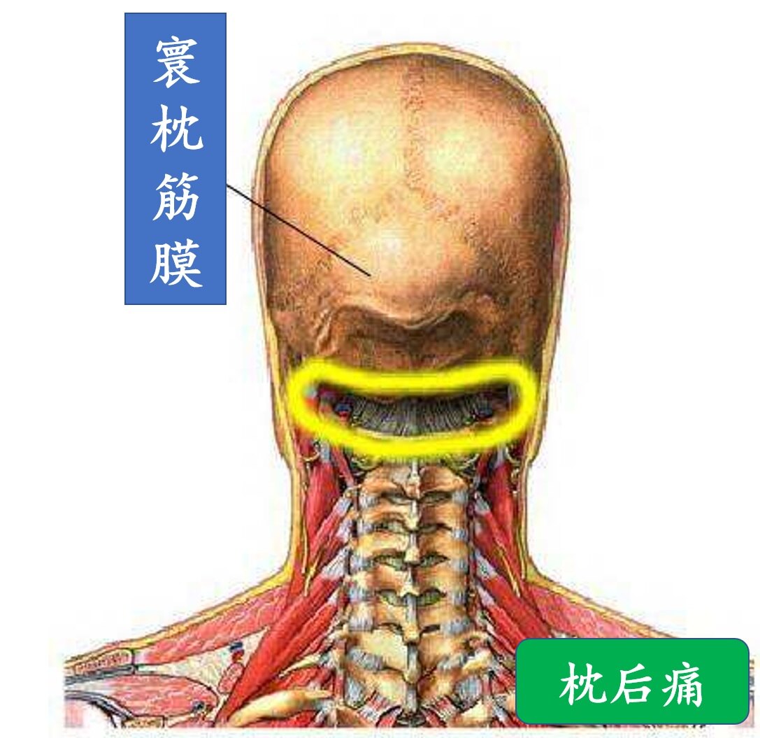 颈部筋膜炎的症状图图片