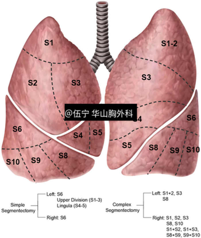 肺叶分段的彩图图片图片