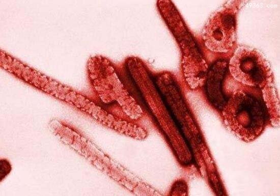 造成5亿人的死亡天花病毒有多可怕?80年代人类宣布消灭它